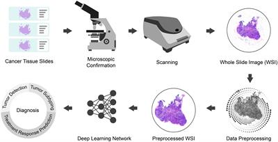 MAMILNet: advancing precision oncology with multi-scale attentional multi-instance learning for whole slide image analysis